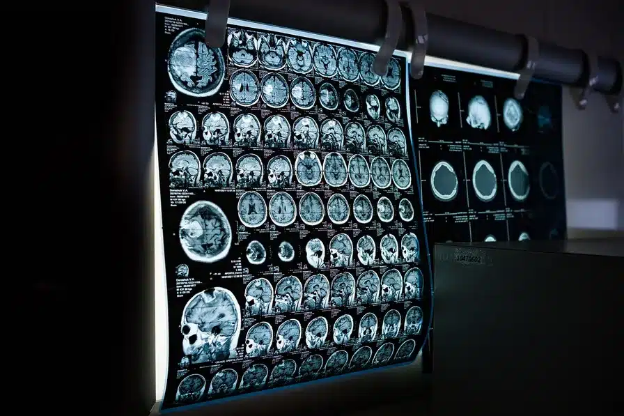 Desarrollo de técnicas de imagen médica como la resonancia magnética y la tomografía computarizada